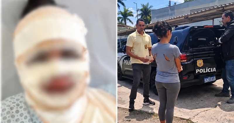 MULHER É PRESA SUSPEITA DE JOGAR ÁGUA FERVENTE NO ROSTO DA NAMORADA DO EX